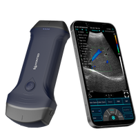 KONTED C10 RLpro Sonda de Ultrasonido Inalámbrica Doppler a Color de Doble Cabezal Convexo Lineal Cardíaca para Dispositivos iOS, Android y Windows