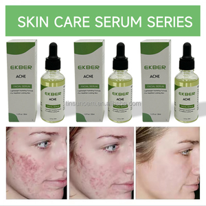 Cosméticos Coreanos, Removedor de Puntos Negros, Cuidado Facial, Antiacné, Suero Blanqueador, OEM - Product Image 2