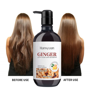 Lotion Shampooing Naturel aux Herbes <span class=keywords><strong>et</strong></span> au Gingembre, Fortifiant les Racines, Anti-Chute pour <span class=keywords><strong>Cheveux</strong></span> <span class=keywords><strong>Fins</strong></span> <span class=keywords><strong>et</strong></span> <span class=keywords><strong>Clairsemés</strong></span> - Product Image 3