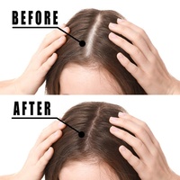 Kualitas Terbaik Organik Vitamin B7 Vegan Akar Jahe Minyak Rambut Pohon Teh Biotin Perawatan Pertumbuhan Rambut Serum Minyak