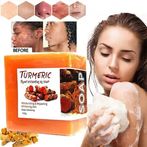 יצרן סבון כורכום עור הפנים & גוף הלבנה כתמים כהים הבהרת טיפול אקנה הלבנת ג 'ינג' ר
