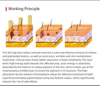 Machine professionnelle portative de détatouage de laser de Nd Yag commutée par Q rayons de laser de Pico pour l'équipement de beauté