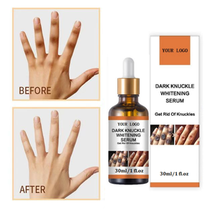Serum exfoliante personalizable, pequeño, para piel opaca, pigmento negro, exfoliante de manos, tobillos, rodillas, suero para despegar - Product Image 5