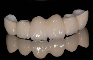 Disk Zirkonia Gigi Ultra Transparan 45%-50% Transmisi Cahaya 100% Bubuk <span class=keywords><strong>Tosoh</strong></span> - Product Image 6