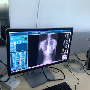 Máy <span class=keywords><strong>X</strong></span> Quang Cầm Tay Máy <span class=keywords><strong>X</strong></span> Quang Thú Y <span class=keywords><strong>X</strong></span> Quang Cầm Tay Cho Pet Với Màn Hình Cảm Ứng - Product Image 5
