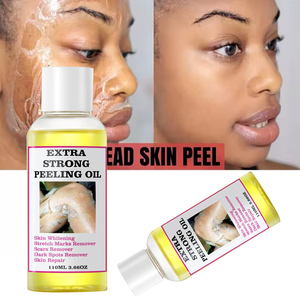Huile de Peeling Jaune <span class=keywords><strong>Extra</strong></span>-Forte pour l'Éclaircissement des Jointures, l'Élimination des Peaux Mortes, l'Exfoliation et Anti-Taches Foncées - Product Image 3