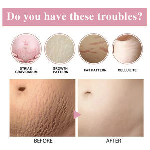 ZS etkili büyüme faktörü streç işareti EGF onarım Serum obezite işaretleri streç işaretleri skar kaldırma MTS doğum sonrası tamir kiti - Product Image 2