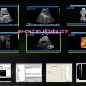 Système d'échographie numérique complet T11 sur chariot, échographe N&B USG pour usage vétérinaire et humain avec sonde - Product Image 6