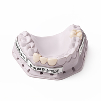 Inlays et surlays en verre-céramique de qualité supérieure pour laboratoires dentaires et cliniques, restaurations orthodontiques personnalisées, haute qualité, livraison rapide