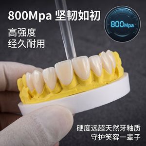 Carillas de Porcelana Lingxi Blancas Naturales de Simulación para Blanqueamiento y Restauración Dental, Uso en Adultos - Product Image 3