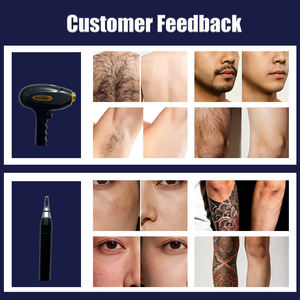 Dispositivo de Depilación con Tecnología de Diodo de Enfriamiento por Hielo de 808 nm, Dispositivo Profesional para el Cuidado de la <span class=keywords><strong>Piel</strong></span>, Tratamiento Rápido - Product Image 4