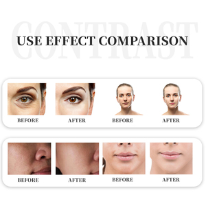 2025 più recente Laser frazionario 1470nm 1470 nm per la macchina di rimozione della cicatrice e della grinza 1470 nm laser di bellezza - Product Image 4