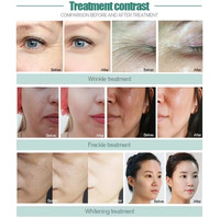 ZS Jet Peel Hydratant Spray Hydratant Visage Oxygène Jet D'eau Peel Machine Non-invasive Mésothérapie Injection Jet Peel Dispositif