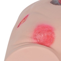 Modèle d'ulcère du coccyx en plastique, simulation de plusieurs types de plaies pour la formation en soins médicaux, éducation aux ulcères de pression et soins infirmiers