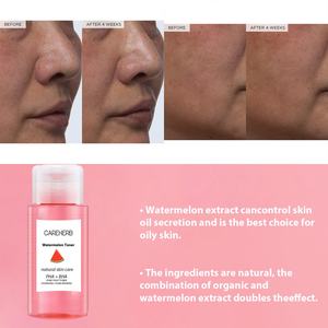 OEM Skin <b>Care</b> Pore Minimizer Exfoliating Hydrating Brightening PHA BHA Watermelon Glow Facial Toner - Product Image 5