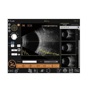 Precio de Fábrica, Aprobado por CE, InnoVue Opto OAB-1000, Ultrasonido Oftálmico Multimodo, Integración Sencilla, Fácil Operación para Ópticas - Product Image 3