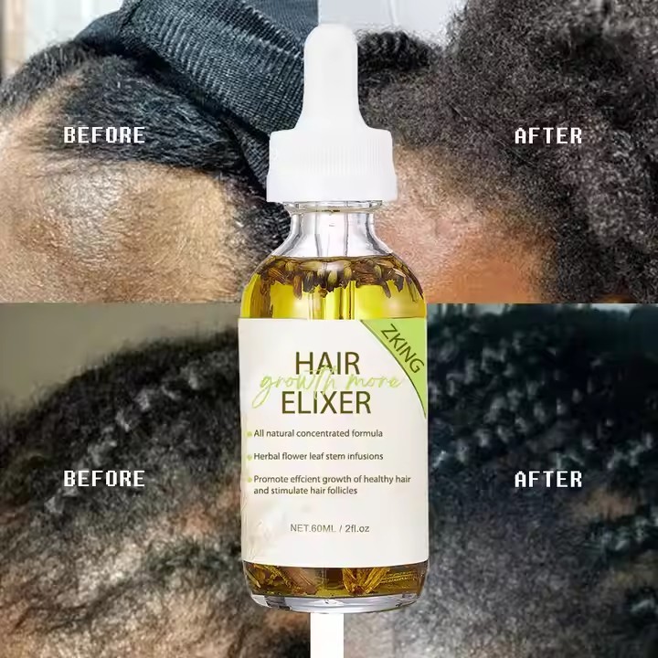 Wholesale Strengthening Nourish Hair Scalp Care