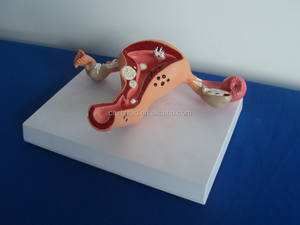 Modelo de Entrenamiento de Patología Médica: Maniquí de Agrandamiento Uterino de PVC de Tamaño Real Avanzado para Uso en Escuelas de Medicina y Hospitales - Product Image 2