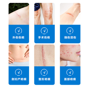 In Conlia Medical Grade Silicone Scar Patch Thickened Skin Colored For Cesarean Section Repair - Product Image 1