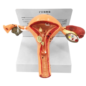 Modelo de útero patológico para mujer, modelo médico femenino para demostración - Product Image 6