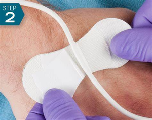 Alat Pengaman Kateter Silikon 3*9cm Arrow PICC/CVC Foley Tube Fixation Gule - Product Image 4