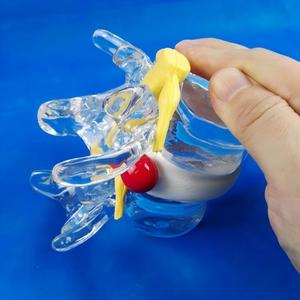 Anatomi Öğretimi için İntervertebral Disk Sıkıştırma Göstergeli Şeffaf İnsan Bel Omuru Modeli - Product Image 3
