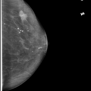 Equipo de Mamografía HF de Bajo Precio, Suministro de Fábrica, Equipo Radioactivo para Máquina de Imágenes de Mama por Rayos X MX-98B - Product Image 3
