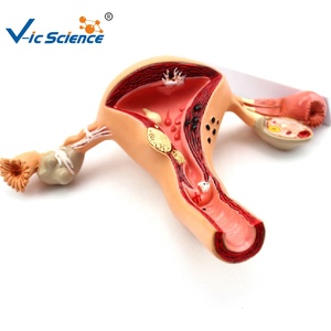 Khoa học y tế mô hình tử cung mô hình giáo dục tử cung giải phẫu người - Product Image 3