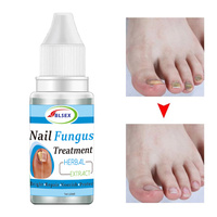 Solution liquide antifongique pour le traitement des mycoses des ongles 10g Formule sûre favorisant la croissance et la réparation saine des ongles des pieds