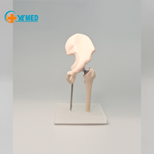 Modello di Sostituzione dell'Anca in Scala Ridotta per Comunicazione Clinica tra Ortopedisti e Pazienti - Product Image 5