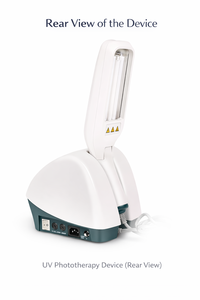 Dispositivo de Fototerapia NB-UVB Portátil Kernel 311NM para el <span class=keywords><strong>Tratamiento</strong></span> de <span class=keywords><strong>Dermatitis</strong></span>, Psoriasis, Vitíligo y Eccema - Product Image 3