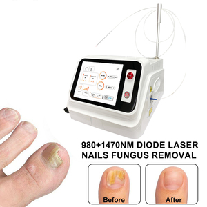 Máquina Láser de Diodo de 980nm para Tratamiento de Hongos en las Uñas de los Pies (Onicomicosis) y Eliminación <span class=keywords><strong>Capilar</strong></span> Vascular - Product Image 3