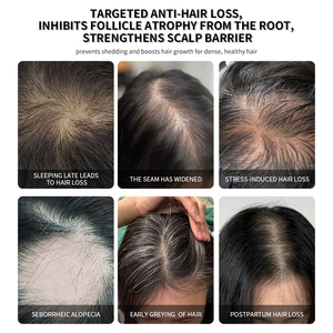 Suero Anticaída Más Vendido, Tratamientos para el Crecimiento del Cabello, Cuidado del Cuero Cabelludo, Venta al Por Mayor - Product Image 6
