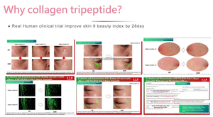Klinik doğrulama 28Day beyazlatma Gluta Glow Sparkle sıvı cilt-aydınlatma C vitamini biyotin kollajen Protein içecek takviyesi - Product Image 2