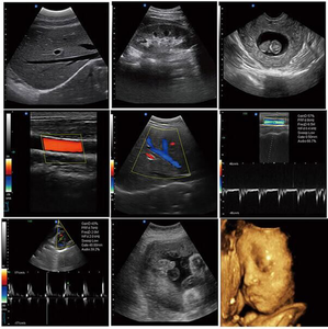 JM-906B Échographe Doppler Couleur à Haute Résolution d'Imagerie pour les Voies Vaskulaires Abdominales et les Petits Organes MSK, Sonde Linéaire, Appareil Doppler Couleur - Product Image 5