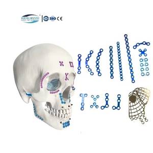 Piastra maxillo-facciale in titanio con impianti chirurgici ortopedici medici di alta qualità - Product Image 1