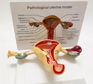 Modèle anatomique de l'utérus <span class=keywords><strong>humain</strong></span> en PVC de haute qualité, structure pathologique gynécologique, organes reproducteurs féminins pour l'enseignement CE/ISO - Product Image 4
