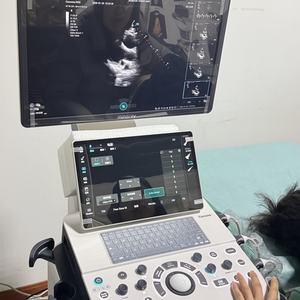 Système d'échographie diagnostique Mindray très vendu, appareil d'imagerie échographique 4D avec Doppler couleur - Product Image 1