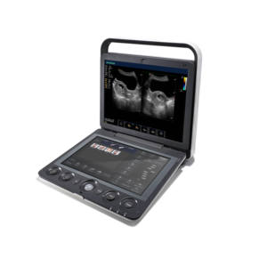 Sonoscape S9 Pro dengan Sonoscape Linear Probe <span class=keywords><strong>Echocardiography</strong></span> Ultrasound Machine - Product Image 4