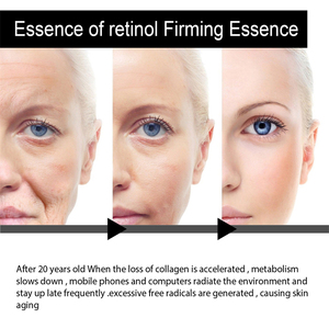 Suero facial con retinol Ouhoe para el cuidado de la piel, antienvejecimiento, reafirmante, hidratante, para eliminar las estrías nasolabiales y periorales. - Product Image 3