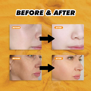 Crema Viso al Collagene Biologico e Curcuma 50g, Idrata e Illumina il Tono della Pelle, Schiarisce le Macchie Scure, per Tutti i Tipi di Pelle - Product Image 6