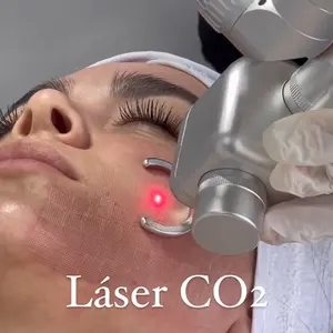 JONTE kualitas tinggi pengencangan vagina fraksional pemotong laser co2 menandai perawatan jerawat fraksional mesin laser dengan CE