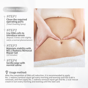 Crème PDRN Efficace pour l'Élimination des Cicatrices, des Boutons d'Acné et des Vergetures, Crème Lissante et Raffermissante Anti-Vergetures, Crème Réparatrice des Cicatrices - Product Image 5