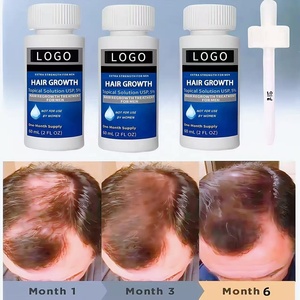 Siero e Olio per la Crescita dei <span class=keywords><strong>Capelli</strong></span> a Marchio Privato OEM, Formula alla Biotina per <span class=keywords><strong>Capelli</strong></span> Fini, Cura del Cuoio Capelluto Cruelty Free per la <span class=keywords><strong>Perdita</strong></span> di <span class=keywords><strong>Capelli</strong></span> <span class=keywords><strong>Maschile</strong></span> - Product Image 2