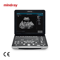 Ecógrafo Veterinario Portátil Mindray DP50 en Blanco y Negro con Sonda Microconvexa 65C15EA para Clínica Veterinaria y Hospital