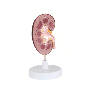 Modello anatomico di calcoli renali ZM2041 6.5*2.5*13 - Product Image 5