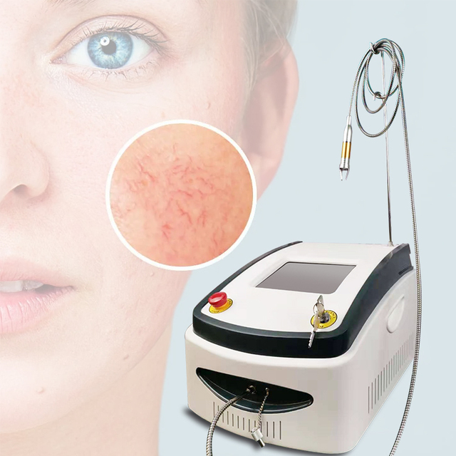 980mn Diode Laser Device Vascular Lesion Therapy Machine /facial Telangiectasias Treatment