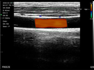 Échographe Doppler couleur sans fil à 128 éléments pour <span class=keywords><strong>smartphone</strong></span> avec transducteur convexe et <span class=keywords><strong>sonde</strong></span> linéaire – <span class=keywords><strong>Prix</strong></span> pour la grossesse - Product Image 5