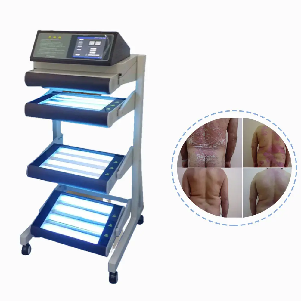 Laserbehandelingen UV-Lamp Vitiligo Kliniek Gebruiken Laserbehandelingen UV-Lamp Vitiligo 36W Philips Lichttherapie