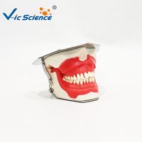 Modelo de Práctica de Odontología Oral, PVC Ecológico, Demostración de Anestesia y Extracción Dental, Entrenamiento para Estudiantes de Odontología, No Tóxico